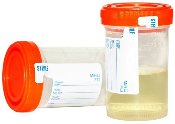 WIRED (Wisdom in Recovery Every Day)